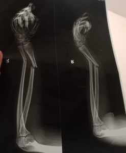 Hasil rontgen (X-Ray) Korban.