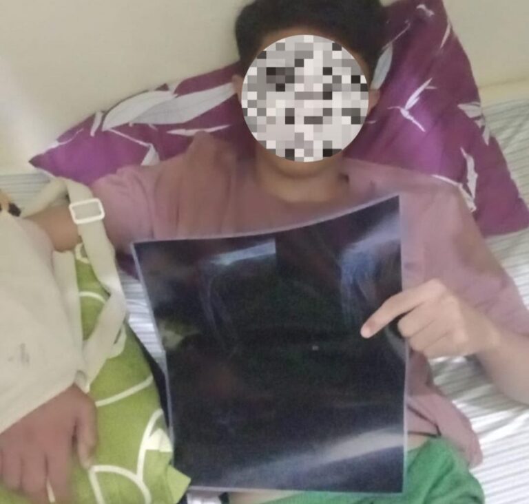 "Seorang remaja 15 tahun di Pontianak Timur mengalami patah tangan usai dikeroyok kelompok OTK saat mempertahankan HP miliknya. Keluarga mendesak Polresta Pontianak segera menangkap pelaku."