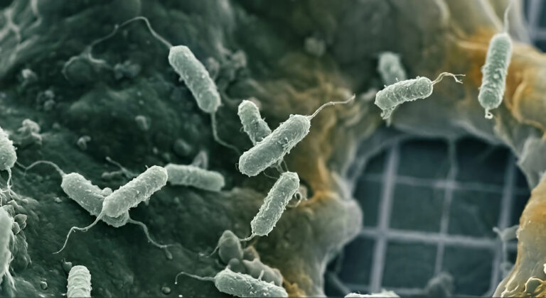 "Pegawai laboratorium di Siberia tewas akibat pneumonia misterius; Donald Trump dan CDC pantau dugaan wabah paru, Rusia bantah kebocoran patogen."